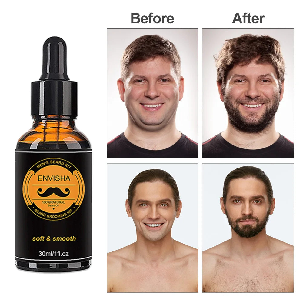 5-Piece Men’s Beard Kit