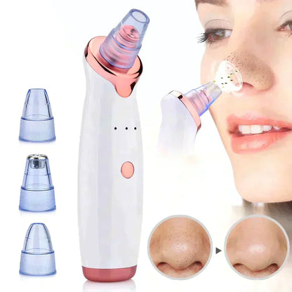 Electric Suction Blackhead Remover